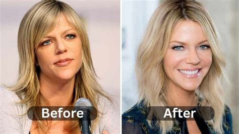 kaitlin olsen plastic surgery|Like a Boss — Kaitlin Olson’s Response to Plastic。